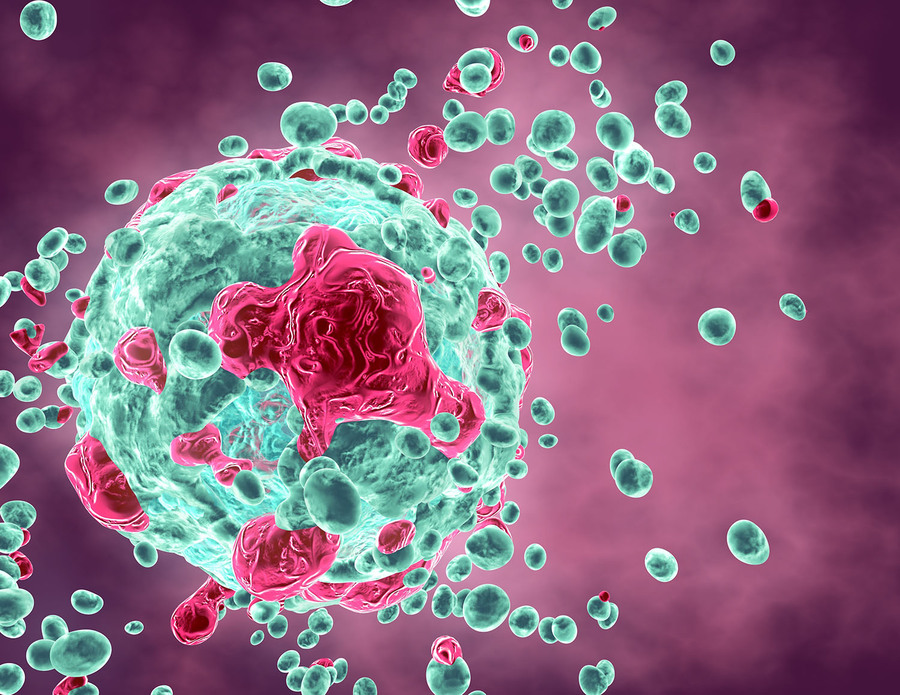 chemioterapia-e-nuovi-farmaci-per-combattere-il-cancro-dell-ovaio