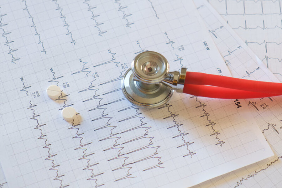 antipertensivi-dopo-l-infarto-guida-ai-farmaci-essenziali-per-il-cuore