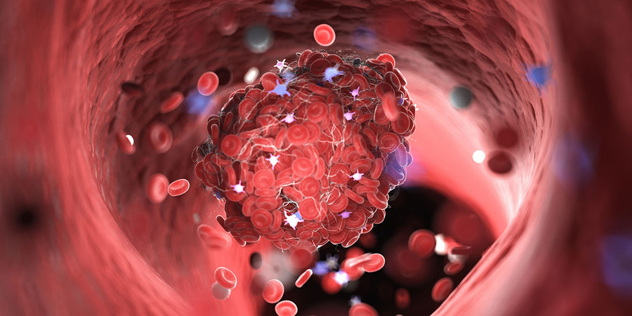 i-farmaci-anticoagulanti-eparinici-quando-servono-e-che-fanno