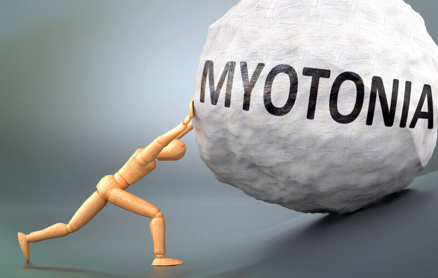 miotonia-congenita-sintomi-terapie-farmacologiche-e-nuove-prospettive-di-cura