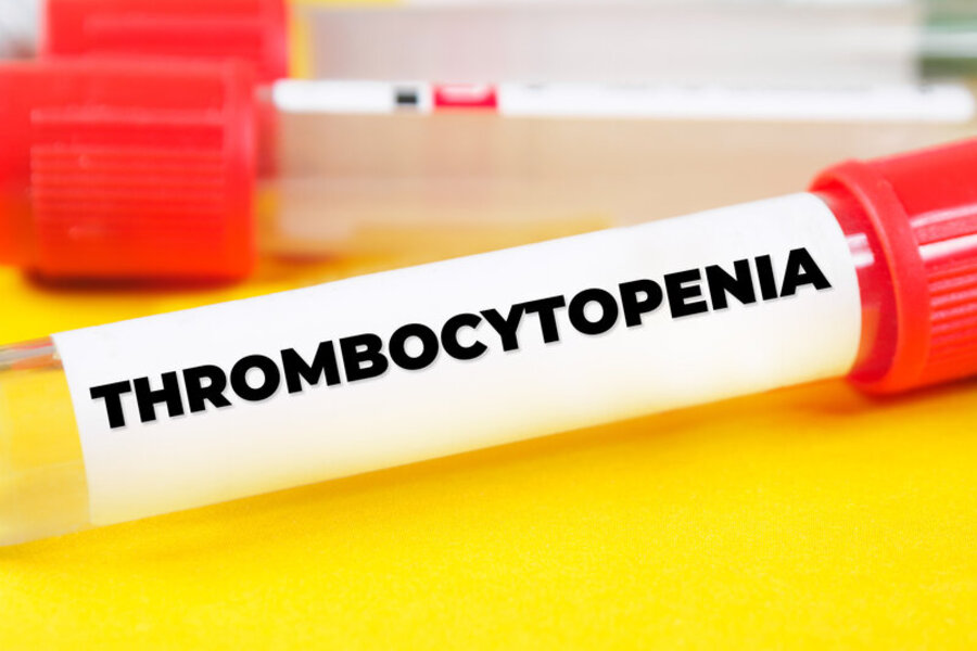 trombocitopenia-immune-sintomi-cause-e-terapie-innovative-per-una-malattia-rara-autoimmune