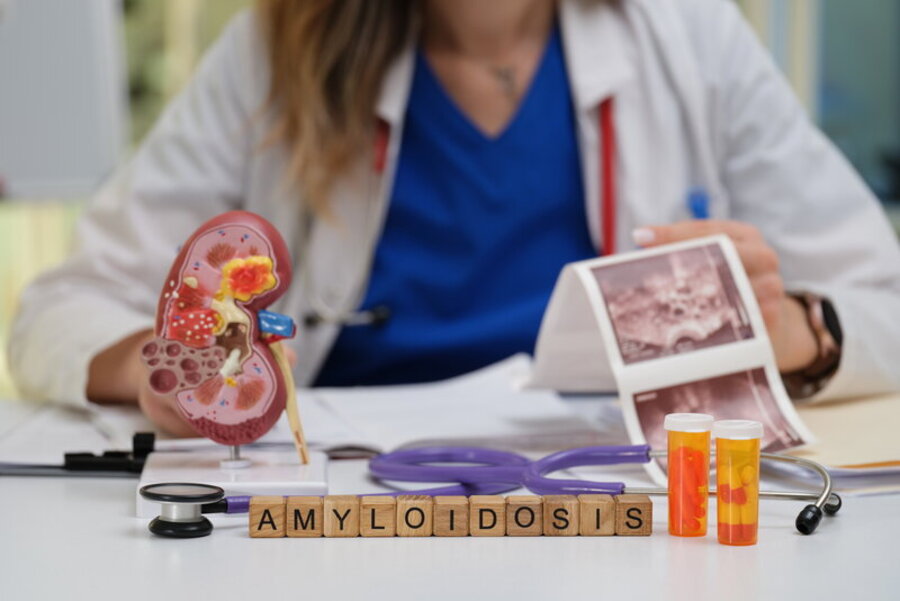 amiloidosi-da-transtiretina-sintomi-diagnosi-e-nuovi-trattamenti-disponibili