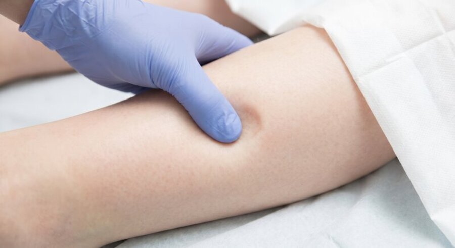 gambe-gonfie-cause-rimedi-e-quando-servono-davvero-i-farmaci