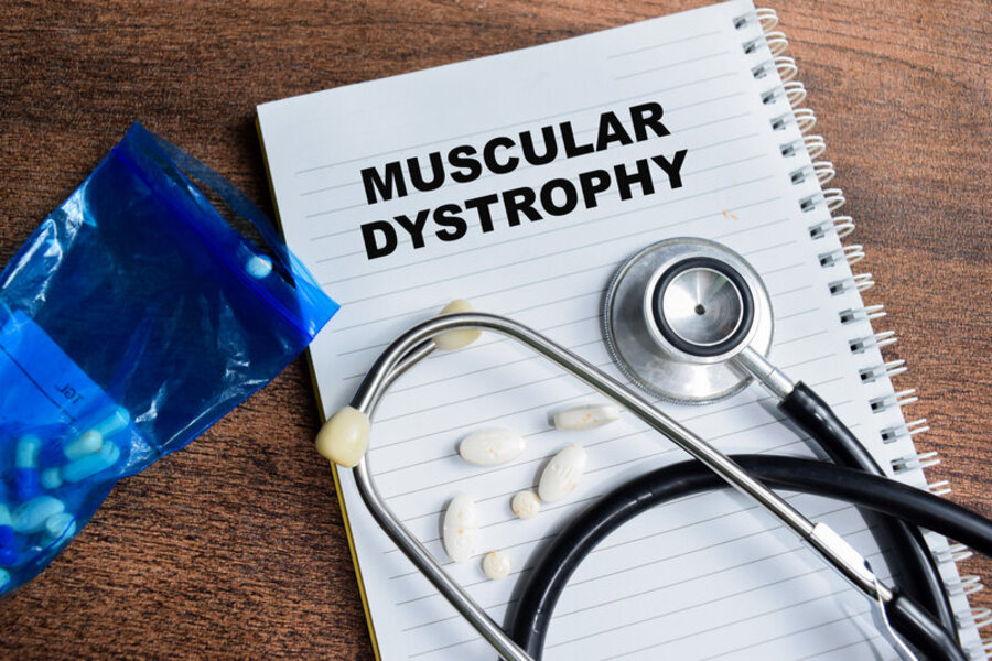 givinostat-nella-distrofia-muscolare-di-duchenne-come-funziona-e-chi-puo-riceverlo